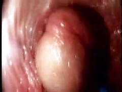TargetVids presents: Video from the inside of a vagina... very interesting